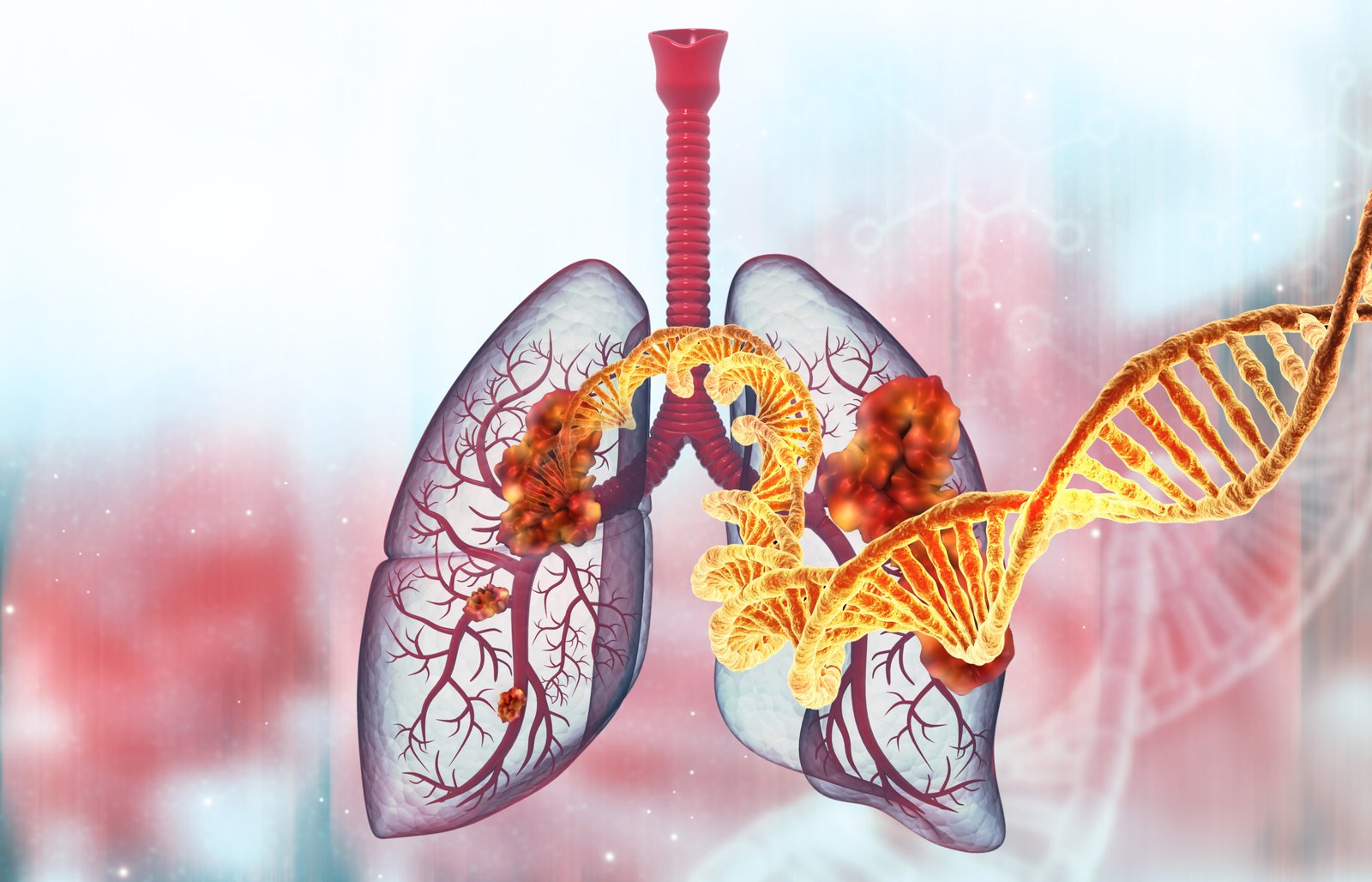 Smoke's lung cancer "can get worse in the areas with air pollution