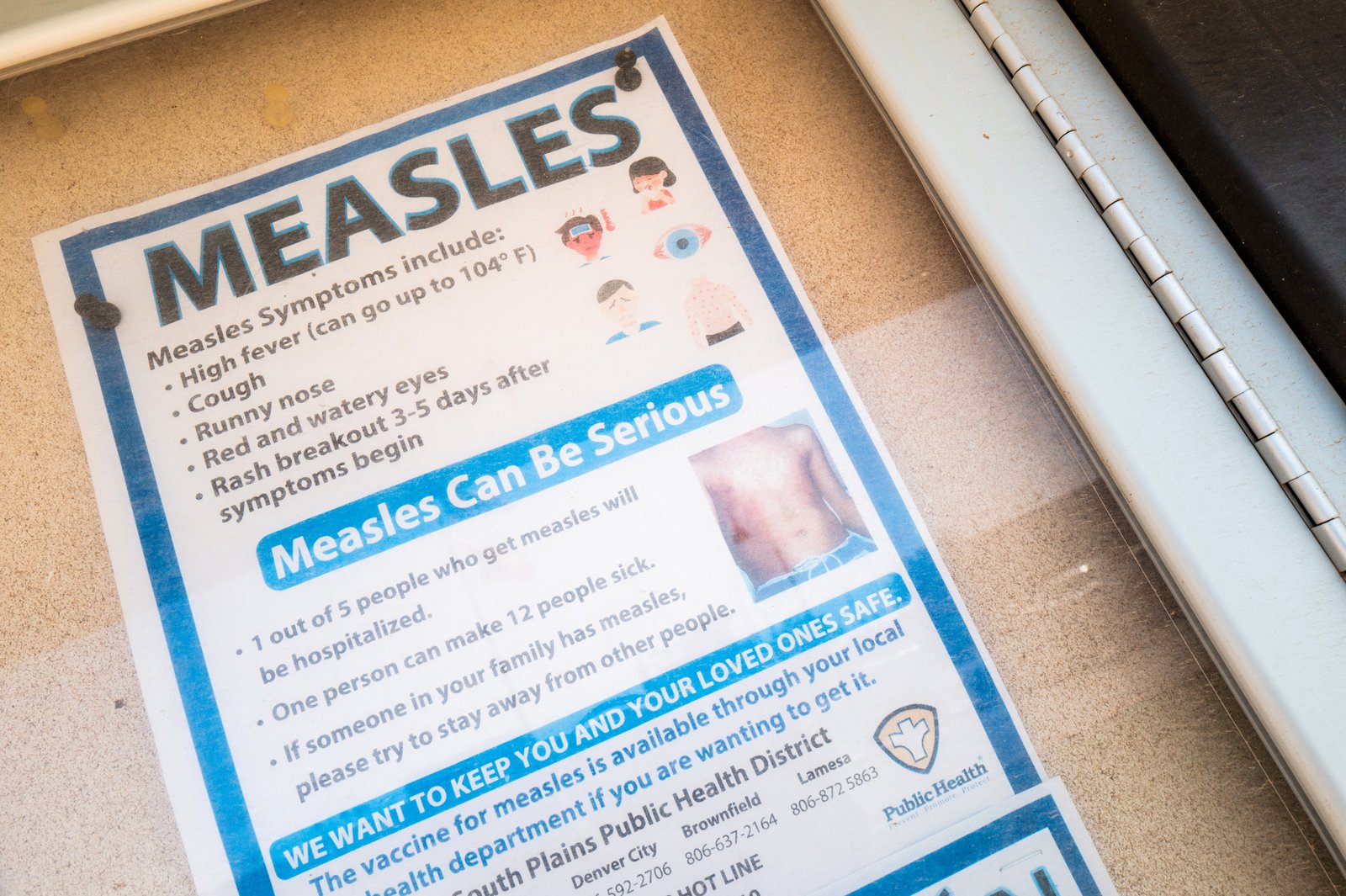 United States cases of the United States at a high time after the disease "deleted"